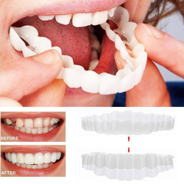 1set Snap On Smile Teeth Veneers Whitening Instant Cosmetic Dentistry Comfortable Veneer Cover Teeth Whitening Smile Denture freeshipping - Etreasurs